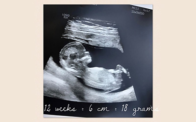 12 week pregnancy update – fertility journey milestone