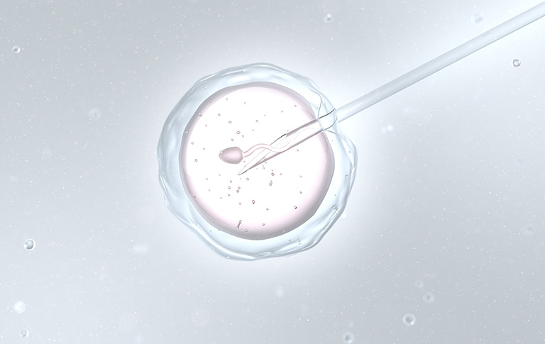 Intracytoplasmic sperm injection (ICSI)