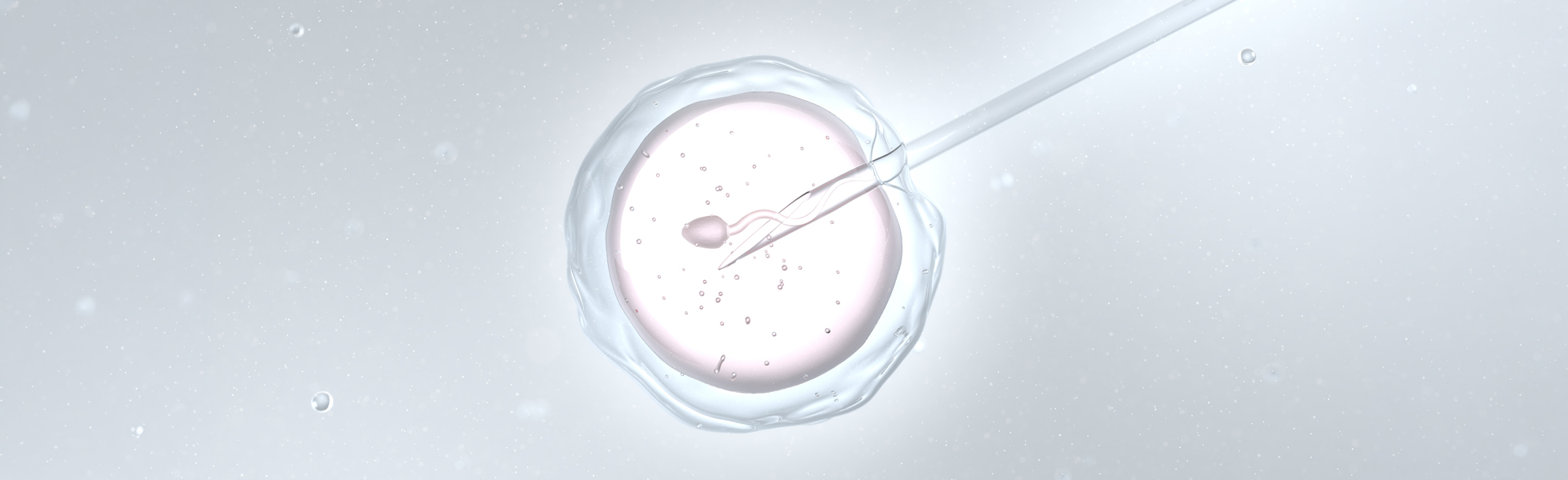 Intracytoplasmic sperm injection (ICSI)