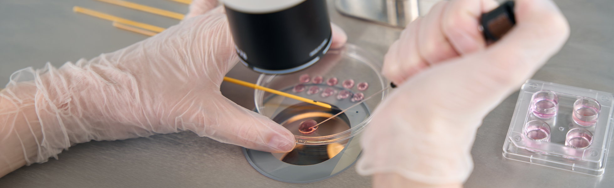 Preimplantation genetic testing (PGT)